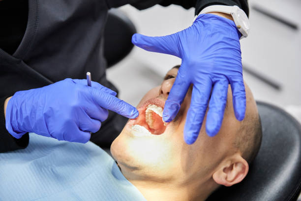 Best Emergency Tooth Extraction in North Haledon, NJ